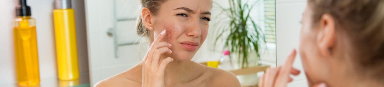 A woman wrapped in a towel examines and touches acne on her cheek while looking in a bathroom mirror.