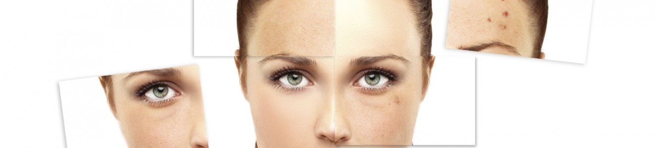 A composite image of a woman's face showing different skin conditions including clear skin, blemishes, and acne patches.