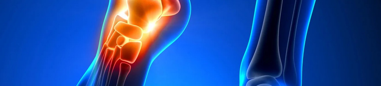 3D illustration showing a pair of human feet with the left ankle bones highlighted in red and orange to indicate pain or inflammation.